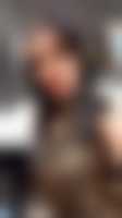 صورة العضو
